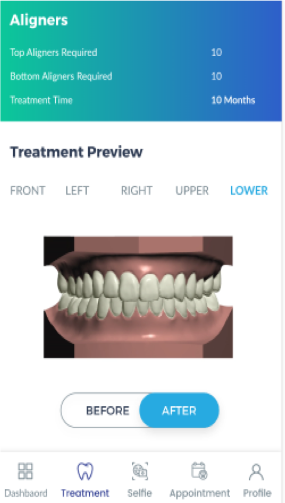 App for Orthodontics 